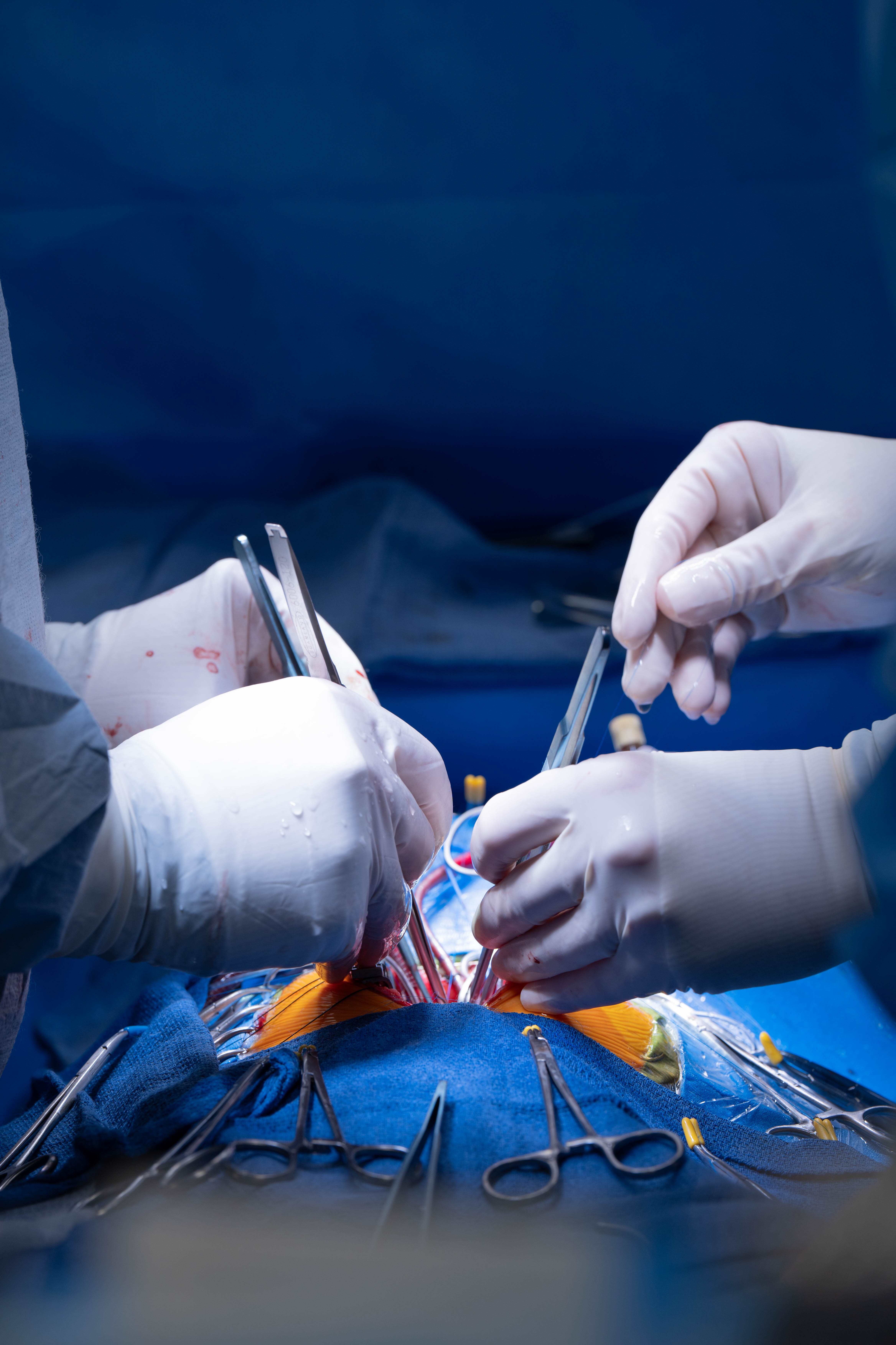 Close-up of two pairs of surgeons' hands, in medical gloves and holding surgical instruments, performing a procedure in an operating room.