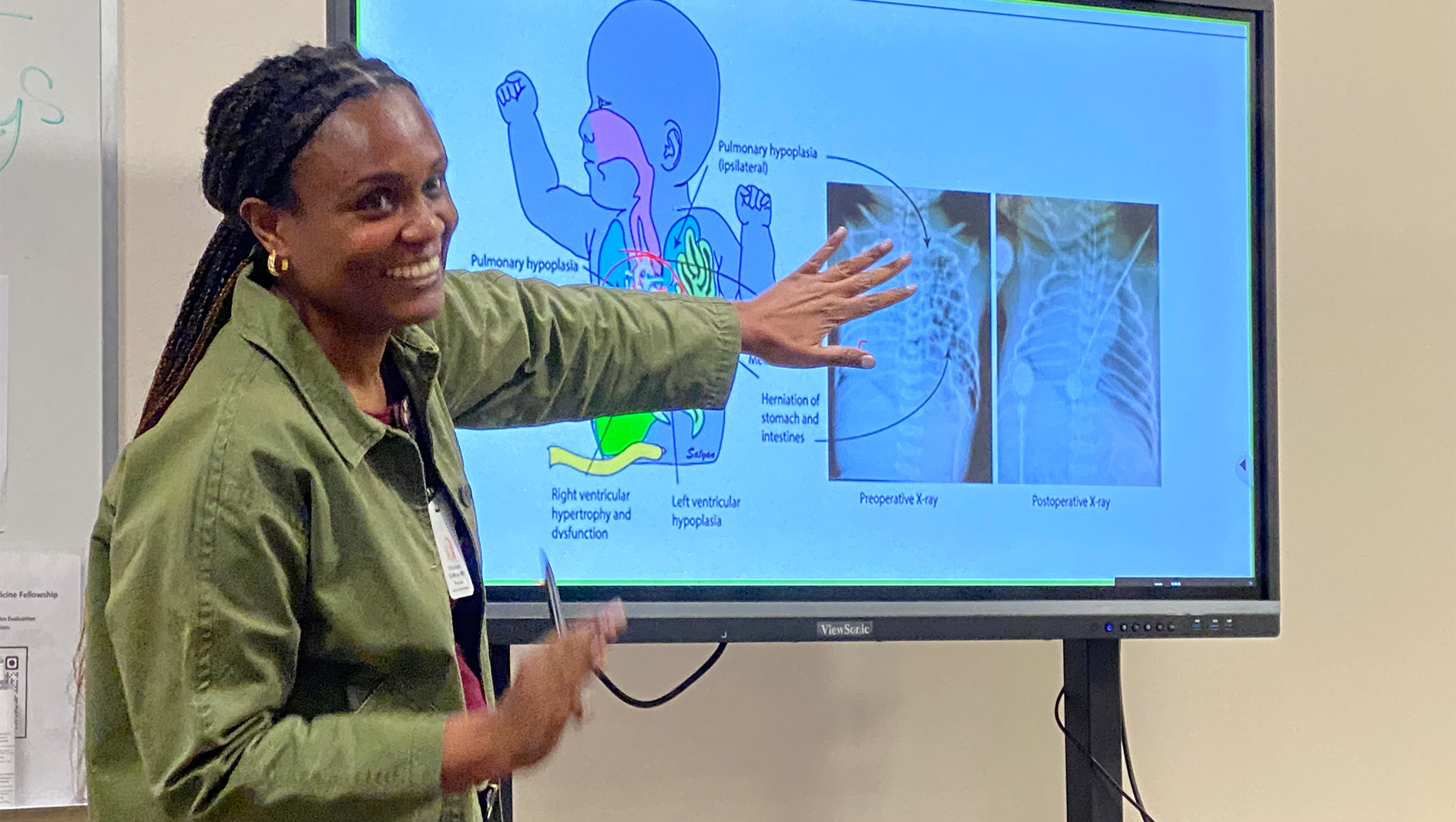 A faculty member from the Neonatal-Perinatal Fellowship lectures in front of a monitor with a medical diagram on the screen.
