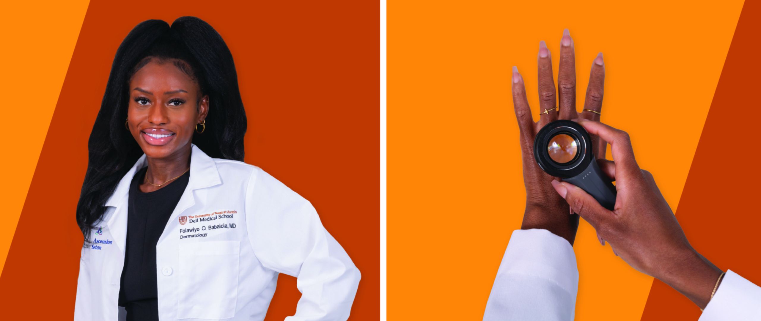 Left: Portrait of Folawiyo Babalola, Right: Hands hold a dermatoscope