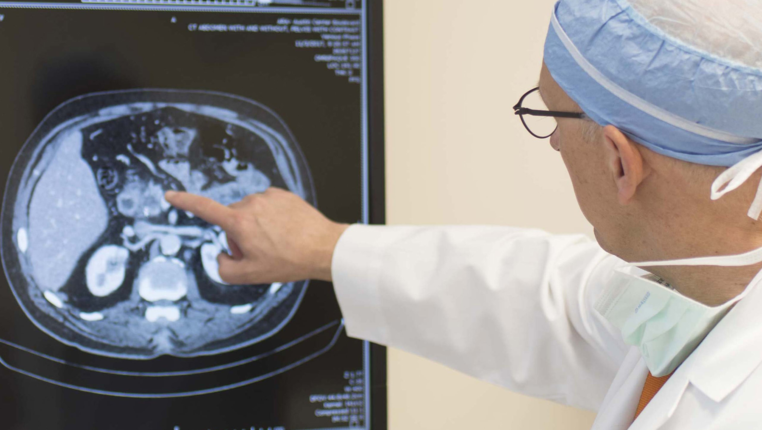 A doctor points at oncology-focused imaging.