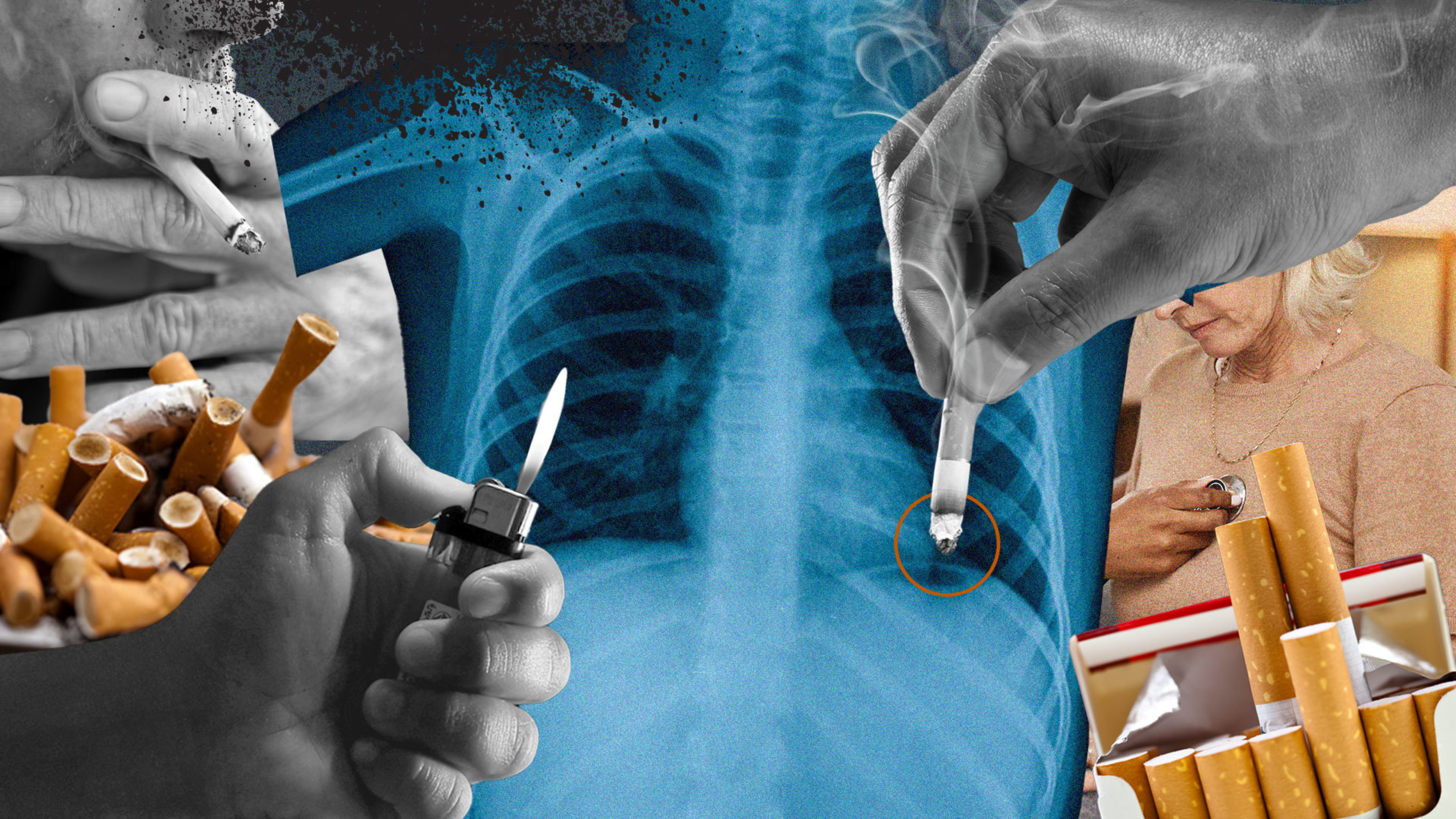Collage of smoking and lung cancer-related images, including a pack of cigarettes, an X-ray of an individuals lungs, a hand holding a lighter and more.